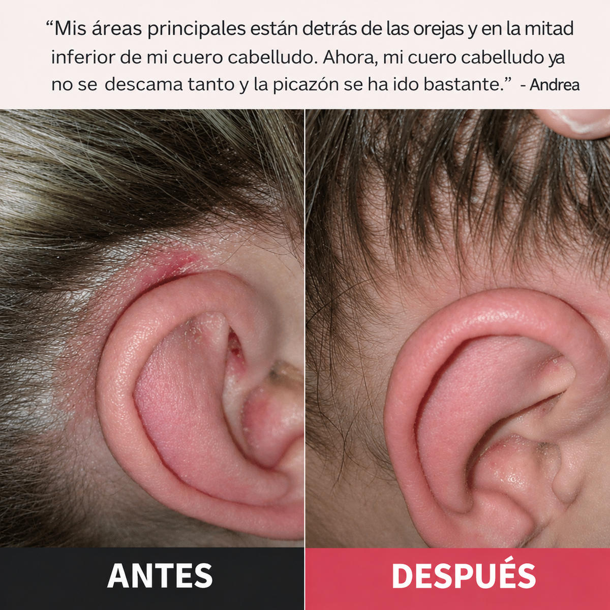 Exfoliante Purificante
