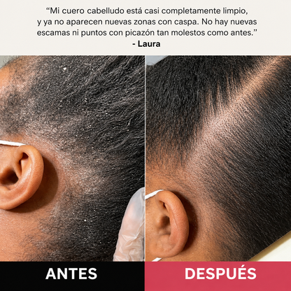 Exfoliante Purificante